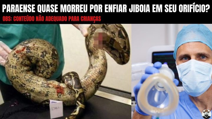 jiboia - Paraense quase morreu por enfiar Jiboia em seu orifício?