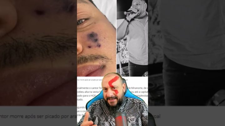 faleceu - Faleceu Cantor de forró Darlyn Morais após ser picado por aranha e rosto, diz família