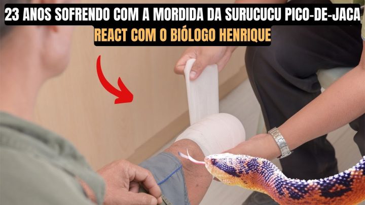 pico-de-jaca! - 23 ANOS SOFRENDO COM A MORDIDA DA SURUCUCU PICO-DE-JACA | Biólogo Henrique Reage | @Isadventure